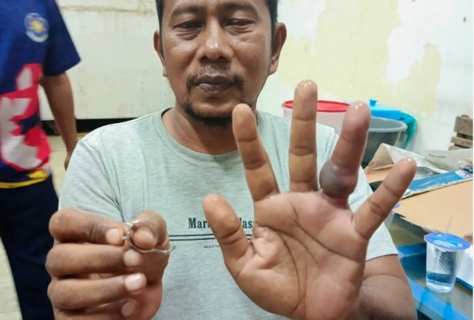 Dinas Pemadam dan Penyelamatan Kota Banda Aceh Berikan Layanan Lepas Cincin