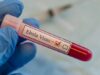 WHO Umumkan Wabah Ebola di Kongo dan Uganda Darurat Kesehatan Internasional